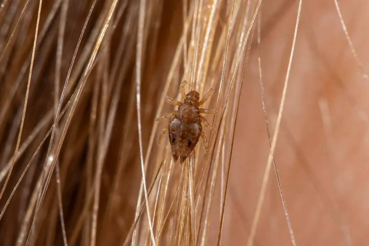 Piolho-de-cabeça adulto agarrado a fio de cabelo em macro